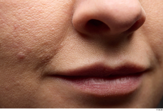 HD Face Skin Zolzaya cheek face lips mouth nose skin…
